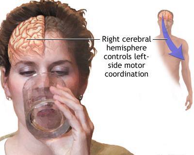 Cerebrum Function Test