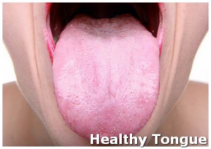 swollen papillae tongue treatment)