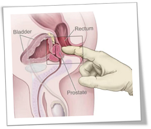 Prostate Rub